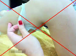 Nám da và cách trị nám da