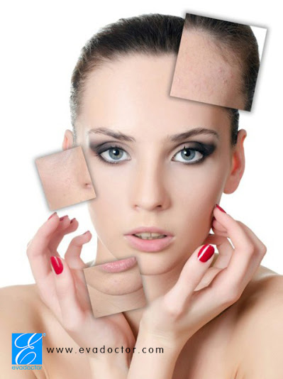 Rau ngót chữa nám, tàn nhang hiệu quả Rau ngót chữa nám, tàn nhang hiệu quả