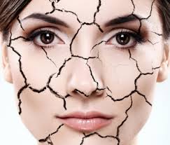 Trị nám da với giá đỗ