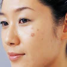 làm đẹp với mướp đắng : giảm đốm nâu