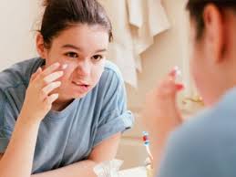 Trị mụn trứng cá tuổi dậy thì